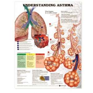 Understanding Asthma Anatomical Chart Unmounted 9862PU:  
