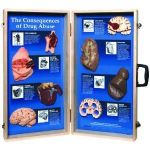  Consequences of Drug Abuse 3D Display, 27 Length x 28 Height Opened